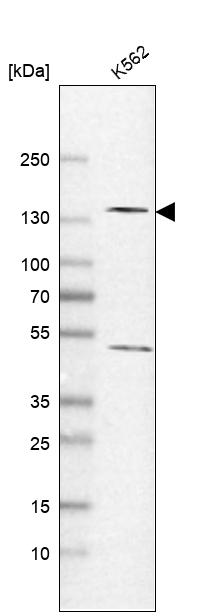 Anti-POLR2B Antibody