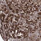 Anti-POC5 Antibody