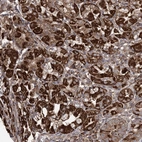 Anti-POC5 Antibody