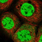 Immunofluorescent staining of human cell line A-431 shows localization to nucleoplasm.