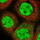 Immunofluorescent staining of human cell line A-431 shows localization to nucleoplasm.