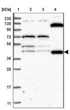 Lane 1: Marker [kDa] 230, 130, 95, 72, 56, 36, 28, 17, 11_br/_Lane 2: Human cell line RT-4_br/_Lane 3: Human cell line U-251 MG_br/_Lane 4: Human plasma