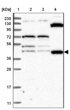 Lane 1: Marker [kDa] 230, 130, 95, 72, 56, 36, 28, 17, 11_br/_Lane 2: Human cell line RT-4_br/_Lane 3: Human cell line U-251 MG_br/_Lane 4: Human plasma