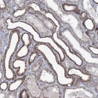 Anti-FAM120B Antibody