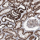Anti-TSSK3 Antibody