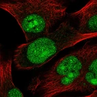 Immunofluorescent staining of human cell line SK-MEL-30 shows localization to nucleus, nucleoli & nuclear bodies.