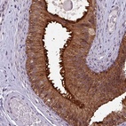 Anti-NPFFR1 Antibody