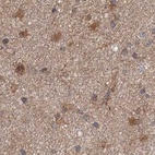 Immunohistochemical staining of human cerebral cortex using Anti-DDO antibody HPA037526.