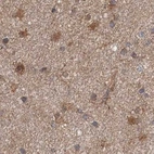 Immunohistochemical staining of human cerebral cortex using Anti-DDO antibody HPA037526.