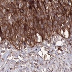 Immunohistochemical staining of human urinary bladder using Anti-DDO antibody HPA037526.