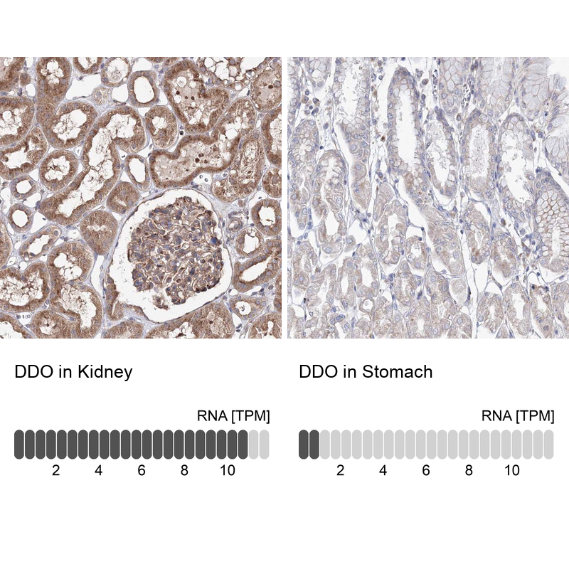 Anti-DDO Antibody