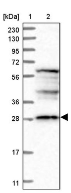Lane 1: Marker [kDa] 230, 130, 95, 72, 56, 36, 28, 17, 11_br/_Lane 2: Human cell line RT-4