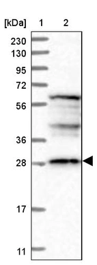 Lane 1: Marker [kDa] 230, 130, 95, 72, 56, 36, 28, 17, 11_br/_Lane 2: Human cell line RT-4