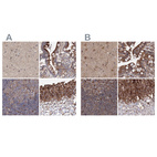 Immunohistochemical staining of human cerebral cortex, colon, lymph node and urinary bladder using Anti-DDO antibody HPA037525 (A) shows similar protein distribution across tissues to independent antibody HPA037526 (B).
