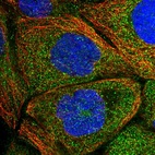 Immunofluorescent staining of human cell line A-431 shows localization to cytosol.