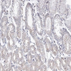 Immunohistochemical staining of human stomach shows low expression as expected.