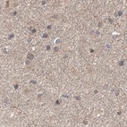 Immunohistochemical staining of human cerebral cortex using Anti-DDO antibody HPA037525.