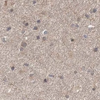 Immunohistochemical staining of human cerebral cortex using Anti-DDO antibody HPA037525.