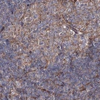 Immunohistochemical staining of human lymph node using Anti-DDO antibody HPA037525.