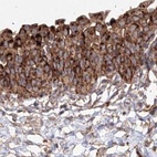 Immunohistochemical staining of human urinary bladder using Anti-DDO antibody HPA037525.