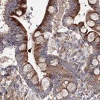 Immunohistochemical staining of human colon using Anti-DDO antibody HPA037525.