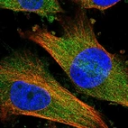 Immunofluorescent staining of human cell line U-251 MG shows localization to cytosol.
