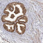 Immunohistochemical staining of human prostate shows moderate cytoplasmic positivity in glandular cells.