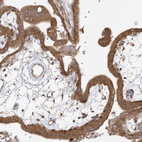 Immunohistochemical staining of human placenta shows moderate cytoplasmic positivity in trophoblastic cells.