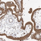 Immunohistochemical staining of human placenta shows moderate cytoplasmic positivity in trophoblastic cells.