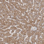 Immunohistochemical staining of human liver shows moderate cytoplasmic positivity in hepatocytes.