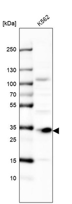 Western blot analysis in human cell line K562.