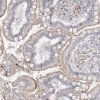 Anti-SH3BP4 Antibody