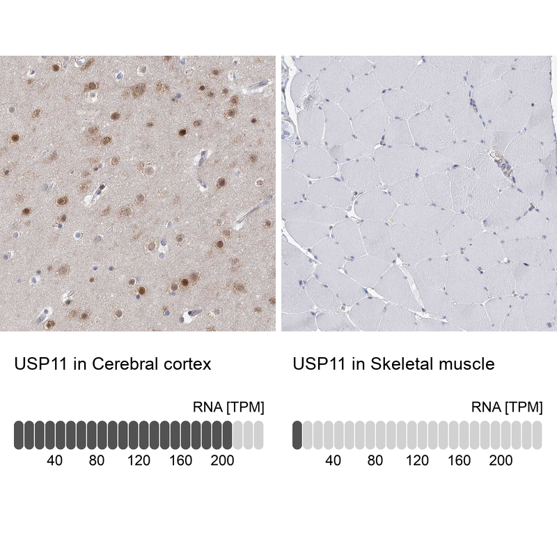 Anti-USP11 Antibody