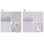 Immunohistochemical staining of human cerebellum, cerebral cortex, skeletal muscle and testis using Anti-USP11 antibody HPA037536 (A) shows similar protein distribution across tissues to independent antibody HPA003103 (B).