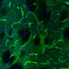 Immunofluorescence staining of mouse caudate putamen shows positivity in blood vessels.