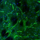 Immunofluorescence staining of mouse caudate putamen shows positivity in blood vessels.