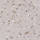 Immunohistochemical staining of human cerebral cortex shows moderate to strong nuclear positivity in neurons.