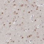 Immunohistochemical staining of human cerebral cortex shows moderate to strong nuclear positivity in neurons.