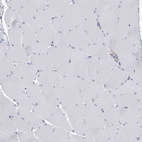 Immunohistochemical staining of human skeletal muscle shows no positivity in myocytes as expected.