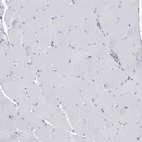 Immunohistochemical staining of human skeletal muscle shows no positivity in myocytes as expected.