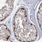 Immunohistochemical staining of human testis shows strong nuclear positivity in a subset of cells in seminiferous ducts.