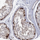 Immunohistochemical staining of human testis shows strong nuclear positivity in a subset of cells in seminiferous ducts.