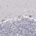 Immunohistochemical staining of human cerebellum shows moderate nuclear positivity in Purkinje cells.