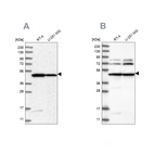 Western blot analysis using Anti-HADHB antibody HPA037540 (A) shows similar pattern to independent antibody HPA037539 (B).