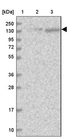 Lane 1: Marker [kDa] 250, 130, 95, 72, 55, 36, 28, 17, 10_br/_Lane 2: Human cell line RT-4_br/_Lane 3: Human cell line U-251MG sp
