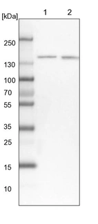 Lane 1: NIH-3T3 cell lysate (Mouse embryonic fibroblast cells)_br/_Lane 2: NBT-II cell lysate (Rat Wistar bladder tumour cells)