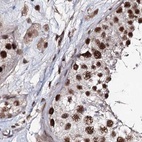 Immunohistochemical staining of human testis using Anti-U2SURP antibody HPA037546.