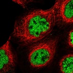 Immunofluorescent staining of human cell line A-431 shows localization to nucleoplasm.