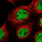 Immunofluorescent staining of human cell line A-431 shows localization to nucleoplasm.