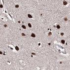 Immunohistochemical staining of human cerebral cortex using Anti-U2SURP antibody HPA037546.